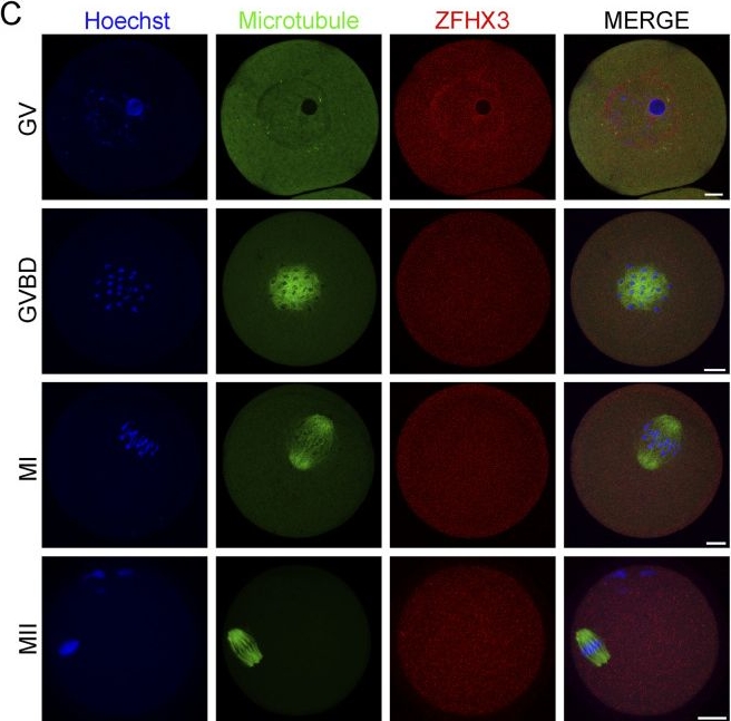 Fig.1.C showing Immunocytochemistry-immunofluorescence in a Mus musculus (House mouse) sample from the publication: Zfhx3 is required for proper spindle assembly and chromosome segregation during oocyte meiosis I in mice.