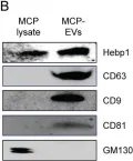 Fig.4.B showing Western Blotting from the publication: Heme-binding protein 1 delivered via pericyte-derived extracellular vesicles improves neurovascular regeneration in a mouse model of cavernous nerve injury.