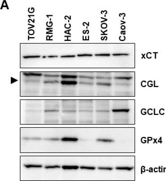 Fig.5.A showing Western Blotting from the publication: Mechanism of Cell Death by Combined Treatment with an xCT Inhibitor and Paclitaxel: An Alternative Therapeutic Strategy for Patients with Ovarian Clear Cell Carcinoma.