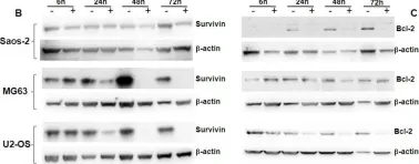 Fig.2.B showing Western Blotting from the publication: Panobinostat mediated cell death: a novel therapeutic approach for osteosarcoma.