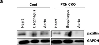 Fig.2.A showing Western Blotting from the publication: Paxillin participates in the sphingosylphosphorylcholine-induced abnormal contraction of vascular smooth muscle by regulating Rho-kinase activation.