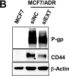 Fig.3.B showing Western Blotting in a Homo sapiens (Human) sample from the publication: Exostosin 1 regulates cancer cell stemness in doxorubicin-resistant breast cancer cells.