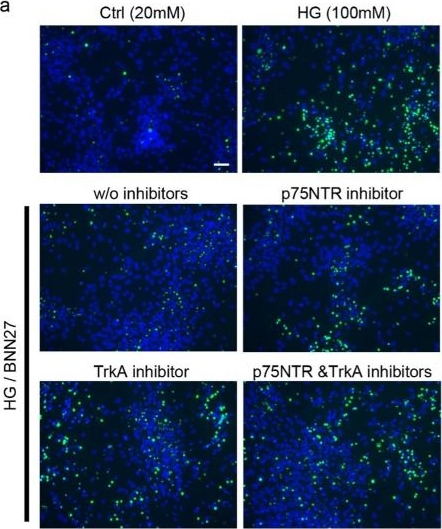Fig.5.A showing Immunocytochemistry-immunofluorescence from the publication: Targeting p75NTR activity alleviates the neurotoxic effect of high glucose on iPSC-derived dopaminergic neurons.