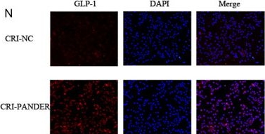 Fig.1.N showing Immunocytochemistry-immunofluorescence from the publication: The role of PANDER and its interplay with IL-6 in the regulation of GLP-1 secretion.
