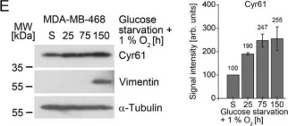 Fig.2.E showing Western Blotting in a Homo sapiens (Human) sample from the publication: Cysteine-Rich Angiogenic Inducer 61: Pro-Survival Function and Role as a Biomarker for Disseminating Breast Cancer Cells.
