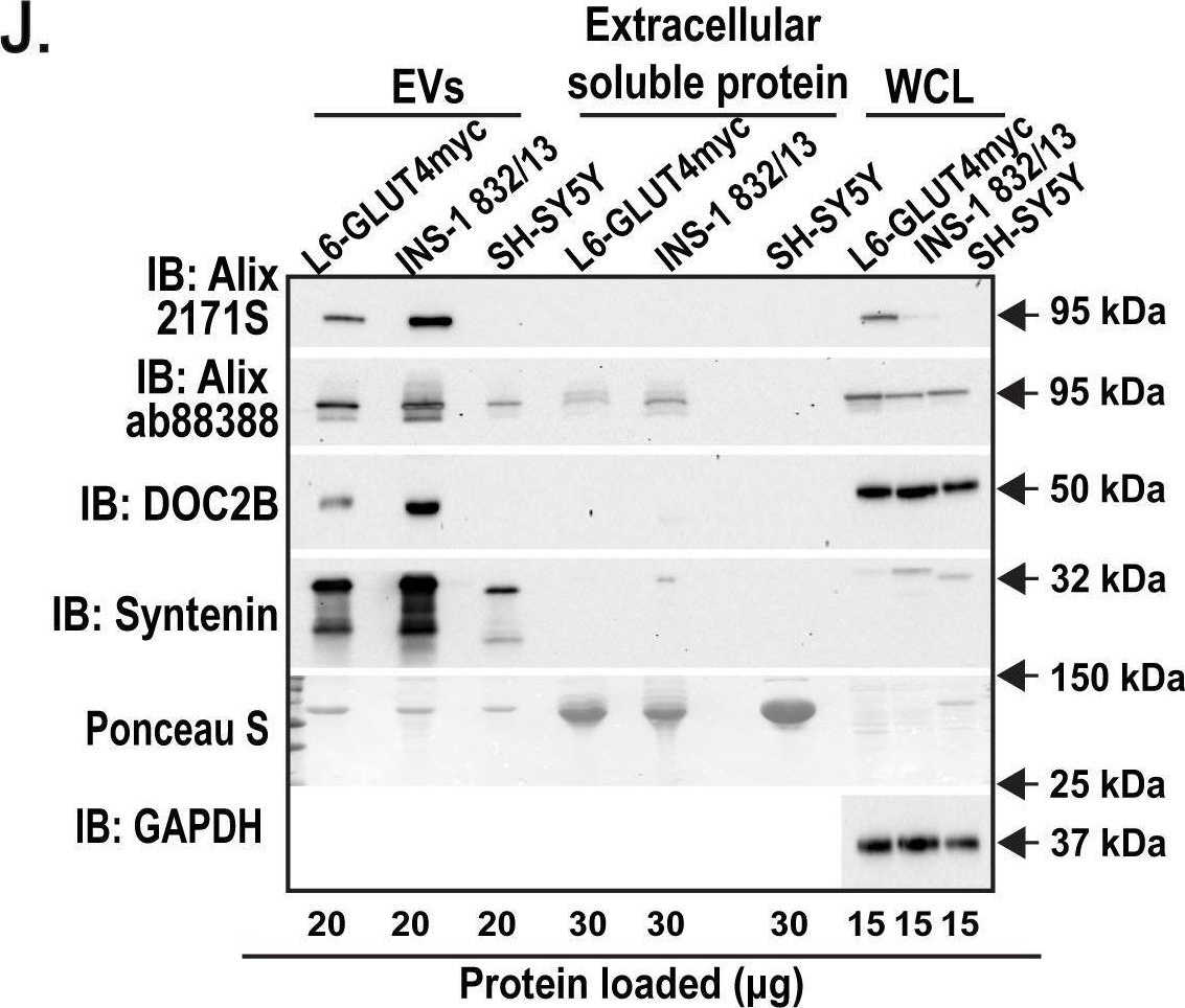 Fig.4.J showing Western Blotting from the publication: Pancreatic β-cells package double C2-like domain beta protein into extracellular vesicles via tandem C2 domains.