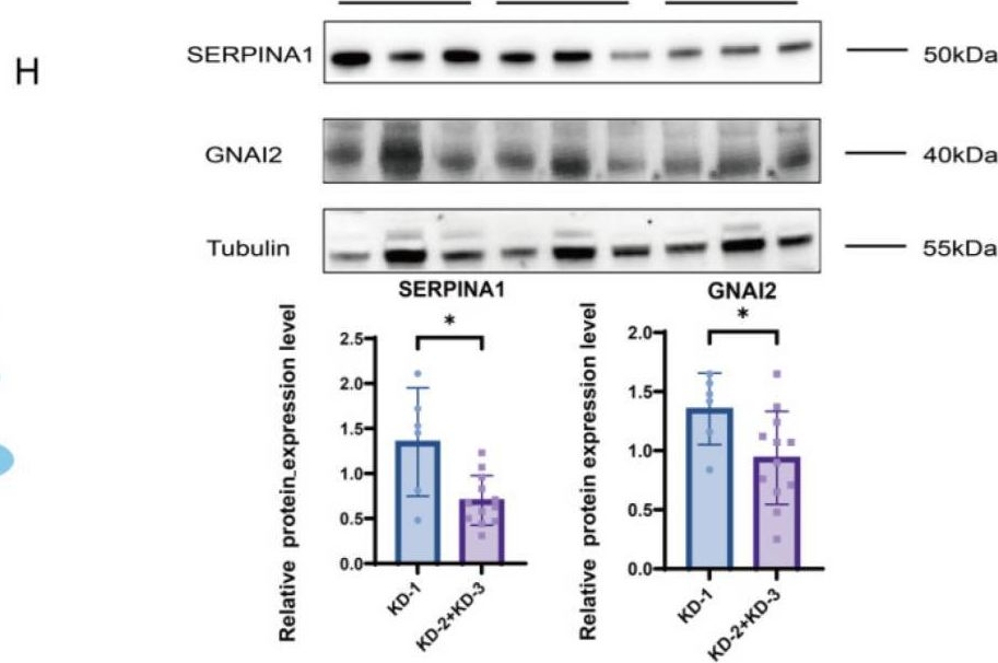 Fig.4.H showing Western Blotting in a Homo sapiens (Human) sample from the publication: Plasma Exosomal-Derived SERPINA1 and GNAI2 Downregulation as Potential Diagnostic Biomarkers of Kawasaki Disease with Coronary Artery Aneurysms.