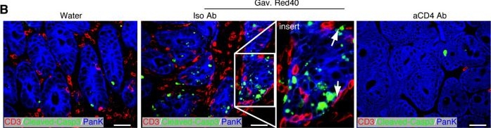 Fig.3.B showing Immunohistochemistry-immunofluorescence in a Mus musculus (House mouse) sample from the publication: IFN-γ+ cytotoxic CD4+ T lymphocytes are involved in the pathogenesis of colitis induced by IL-23 and the food colorant Red 40.