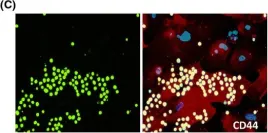 Fig.4.C showing Immunofluorescence in a Homo sapiens (Human) sample from the publication: Premature aging induced by radiation exhibits pro-atherosclerotic effects mediated by epigenetic activation of CD44 expression.