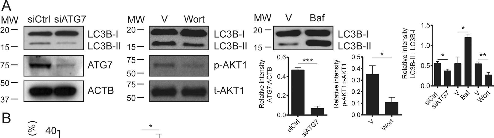 Fig.5.A showing Western Blotting in a Homo sapiens (Human) sample from the publication: Autolysosomes and caspase-3 control the biogenesis and release of immunogenic apoptotic exosomes.