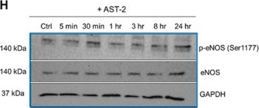 Fig.4.H showing Western Blotting in a Homo sapiens (Human) sample from the publication: Hydropersulfides promote angiogenesis and preserve vascular function.