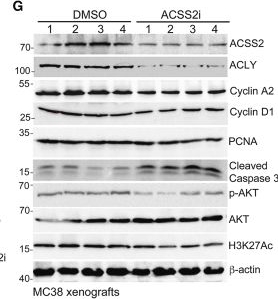 Fig.6.G showing Western Blotting in a Mus musculus (House mouse) sample from the publication: ACSS2 is required for colorectal cancer progression and a druggable target for colorectal cancer treatment.