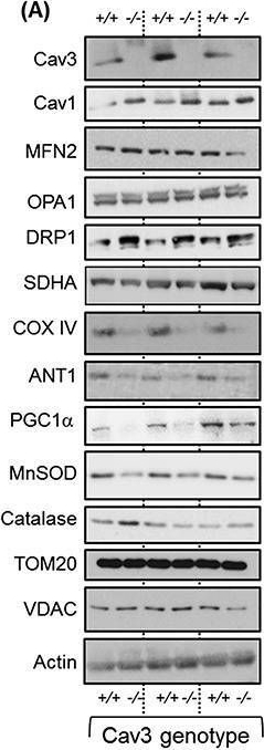 Fig.4.A showing Western Blotting in a Mus musculus (House mouse) sample from the publication: Caveolin-3 deficiency associated with the dystrophy P104L mutation impairs skeletal muscle mitochondrial form and function.