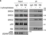 Fig.2.C showing Western Blotting from the publication: Retinoblastoma protein as an intrinsic BRD4 inhibitor modulates small molecule BET inhibitor sensitivity in cancer.