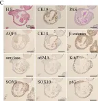 Fig.1.C showing Immunohistochemistry from the publication: Establishment of a novel protocol for formalin-fixed paraffin-embedded organoids and spheroids.