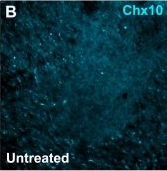 Fig.6.B showing Immunohistochemistry-immunofluorescence in a Mus musculus (House mouse) sample from the publication: Spinal circuit mechanisms constrain therapeutic windows for ALS intervention: A computational modeling study.
