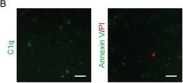 Fig.1.B from the publication: Biogenerated Oxygen-Related Environmental Stressed Apoptotic Vesicle Targets Endothelial Cells.