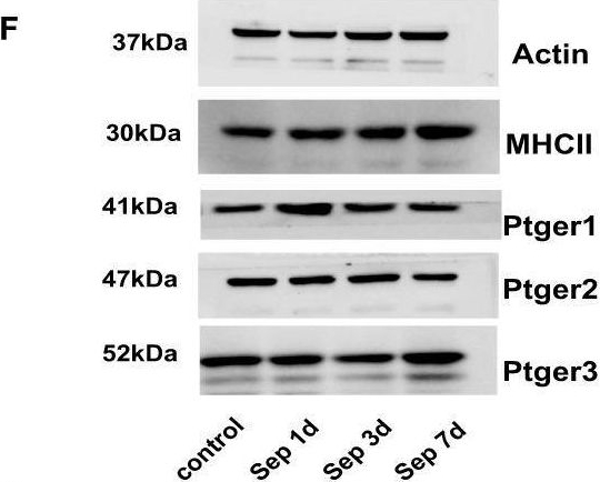 Fig.3.F showing Western Blotting from the publication: The macrophages regulate intestinal motility dysfunction through the PGE2 Ptger3 axis during Klebsiella pneumonia sepsis.