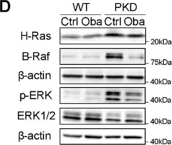 Fig.7.D showing Western Blotting in a Mus musculus (House mouse) sample from the publication: Obacunone Retards Renal Cyst Development in Autosomal Dominant Polycystic Kidney Disease by Activating NRF2.