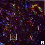 Fig.7.R showing Immunocytochemistry-immunofluorescence in a Mus musculus (House mouse) sample from the publication: IFN-gamma signaling in the central nervous system controls the course of experimental autoimmune encephalomyelitis independently of the localization and composition of inflammatory foci.