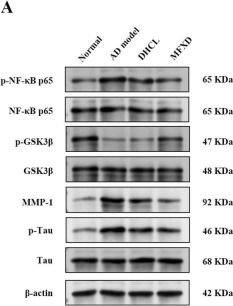 Fig.13.A showing Western Blotting from the publication: Exploring the Mahuang Fuzi Xixin Decoction's mechanism for treating Alzheimer's disease using molecular docking and network pharmacology.