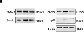 Fig.3.H showing Western Blotting in a Mus musculus (House mouse) sample from the publication: Delphinidin-3-O-glucoside attenuates neonatal hypoxic-ischemic encephalopathy in a neonatal mouse model by reprogramming microglial polarization.