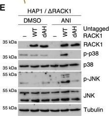 Fig.2.E showing Western Blotting from the publication: Mechanism of RACK1-dependent ZAKα activation at stalled and collided ribosomes.