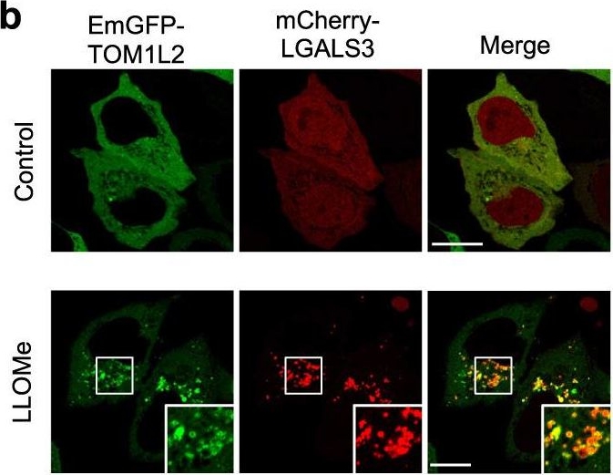 Fig.7.B showing Immunocytochemistry-immunofluorescence in a Homo sapiens (Human) sample from the publication: Rab41-mediated ESCRT machinery repairs membrane rupture by a bacterial toxin in xenophagy.