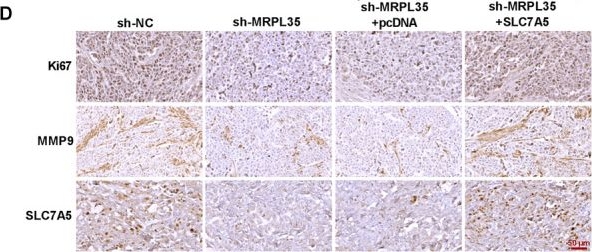 Fig.7.D showing Immunohistochemistry from the publication: MRPL35 Induces Proliferation, Invasion, and Glutamine Metabolism in NSCLC Cells by Upregulating SLC7A5 Expression.