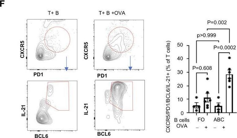 Fig.5.F showing Flow cytometry/Cell sorting from the publication: Phenotypic and functional characteristics of murine CD11c+ B cells which is suppressed by metformin.