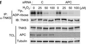 Fig.4.F showing Western Blotting in a Homo sapiens (Human) sample from the publication: Interaction of tankyrase and peroxiredoxin II is indispensable for the survival of colorectal cancer cells.