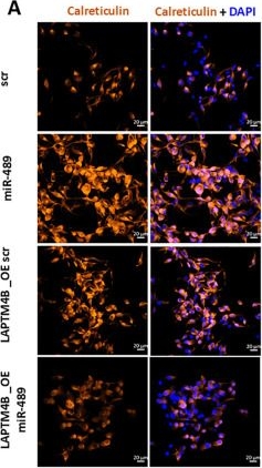 Fig.6.A showing Immunocytochemistry-immunofluorescence from the publication: miR-489 induces immunogenic cell death in breast cancer by targeting LAPTM4B.