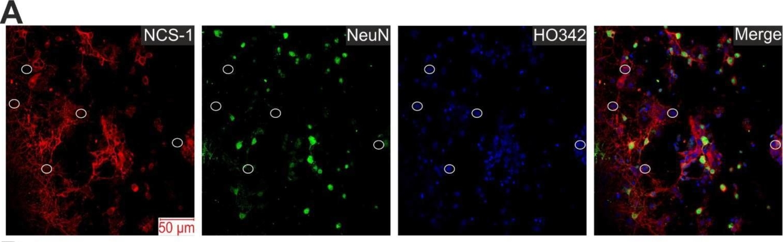 Fig.1.A showing Immunohistochemistry-immunofluorescence in a Homo sapiens (Human) sample from the publication: Neuronal Calcium Sensor-1 Protects Cortical Neurons from Hyperexcitation and Ca2+ Overload during Ischemia by Protecting the Population of GABAergic Neurons.