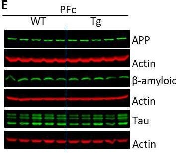 Fig.6.E showing Western Blotting from the publication: Lipid Droplets Accumulation in the Brain of HIV Transgenic Rat: Implication in the Accelerated Aging of HIV Infected Individuals.