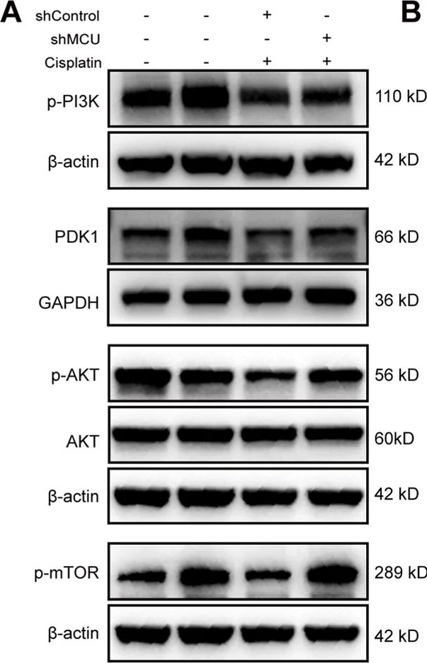 Fig.5.A showing Western Blotting from the publication: MCU knockdown attenuates cisplatin-induced damage of auditory cells: potential involvement of PI3K/AKT/mTOR signaling and autophagy-related processes.