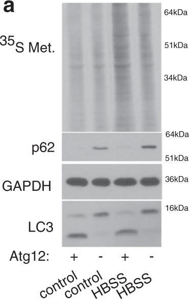 Ribosome profiling reveals a functional role for autophagy in mRNA translational control.