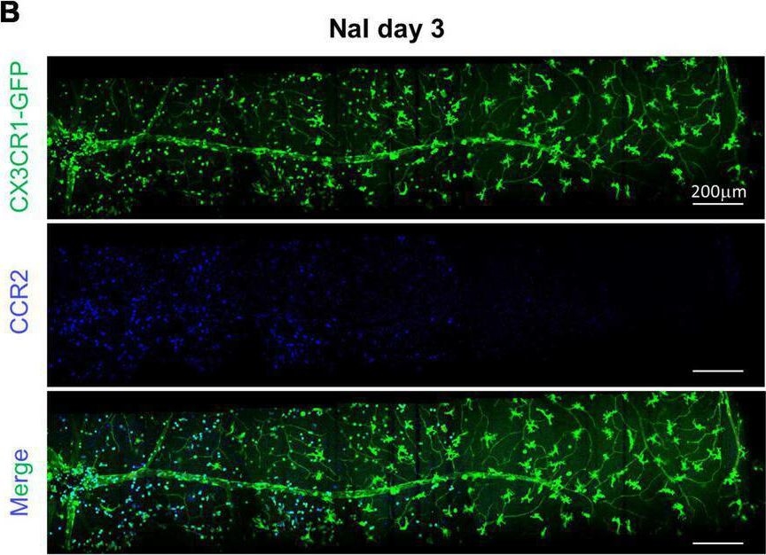 Fig.6.B showing Immunohistochemistry-immunofluorescence in a Mus musculus (House mouse) sample from the publication: Establishment of the reproducible branch retinal artery occlusion mouse model and intravital longitudinal imaging of the retinal CX3CR1-GFP+ cells after spontaneous arterial recanalization.