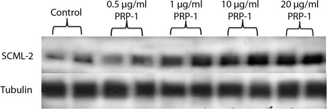 Fig.5.A showing Western Blotting in a Mus musculus (House mouse) sample from the publication: Epigenetic regulation of embryonic stem cell marker miR302C in human chondrosarcoma as determinant of antiproliferative activity of proline-rich polypeptide 1.