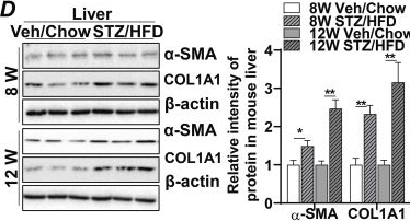 Fig.5.D showing Western Blotting from the publication: Elevated miR-34a induced by lipotoxicity and inflammation mediates pathophysiological communication between hepatocytes and hepatic stellate cells in liver fibrosis.