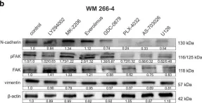 Fig.2.B showing Western Blotting from the publication: mTOR inhibitor everolimus reduces invasiveness of melanoma cells.