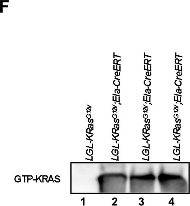 Fig.2.F showing Western Blotting in a Mus musculus (House mouse) sample from the publication: Ductal activation of oncogenic KRAS alone induces sarcomatoid phenotype.