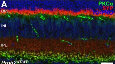 Fig.10.A showing Immunohistochemistry-immunofluorescence in a Mus musculus (House mouse) sample from the publication: Prph2 knock-in mice recapitulate human central areolar choroidal dystrophy retinal degeneration and exhibit aberrant synaptic remodeling and microglial activation.