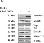 Fig.2.A showing Western Blotting from the publication: Analysis of the relationship between the KRAS G12V oncogene and the Hippo effector YAP1 in embryonal rhabdomyosarcoma.