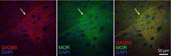 Fig.3.C showing Immunohistochemistry-immunofluorescence in a Mus musculus (House mouse) sample from the publication: Excessive self-grooming, gene dysregulation and imbalance between the striosome and matrix compartments in the striatum of Shank3 mutant mice.
