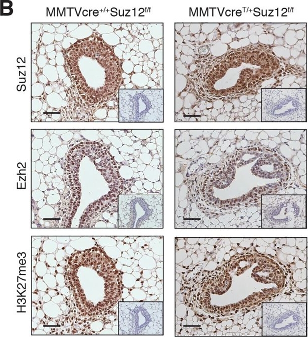 Fig.1.B showing Immunohistochemistry in a Mus musculus (House mouse) sample from the publication: Canonical PRC2 function is essential for mammary gland development and affects chromatin compaction in mammary organoids.