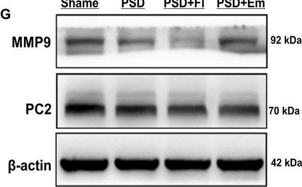 Fig.10.G showing Western Blotting from the publication: Elucidating the Mechanism of Emodin in Treating Post-Stroke Depression Through Network Pharmacology and Animal Experiments.