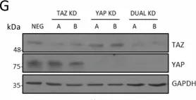 Fig.5.G showing Western Blotting in a Homo sapiens (Human) sample from the publication: The Hippo pathway transcription factors YAP and TAZ play HPV-type dependent roles in cervical cancer.