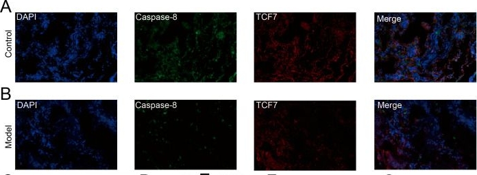 Fig.14.A showing Immunohistochemistry-immunofluorescence in a Homo sapiens (Human) sample from the publication: Unfolding Immune Dysregulation in COPD: Identification of a Three-Gene Signature and Functional Validation of TCF7 in Human Lung Tissue and T Lymphocytes.