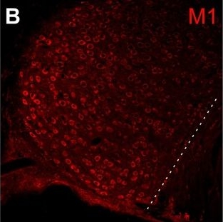 Fig.6.B showing Immunohistochemistry-immunofluorescence in a Meriones unguiculatus (Mongolian gerbil) sample from the publication: Muscarinic modulation of M and h currents in gerbil spherical bushy cells.