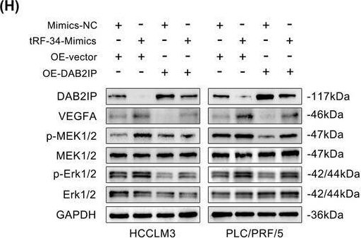 Fig.6.E showing Western Blotting from the publication: tRF-34-P4R8YP9LON4VHM Promotes Hepatocellular Carcinoma Progression and Tumour Cell-Induced Angiogenesis via the MEK/ERK Pathway.